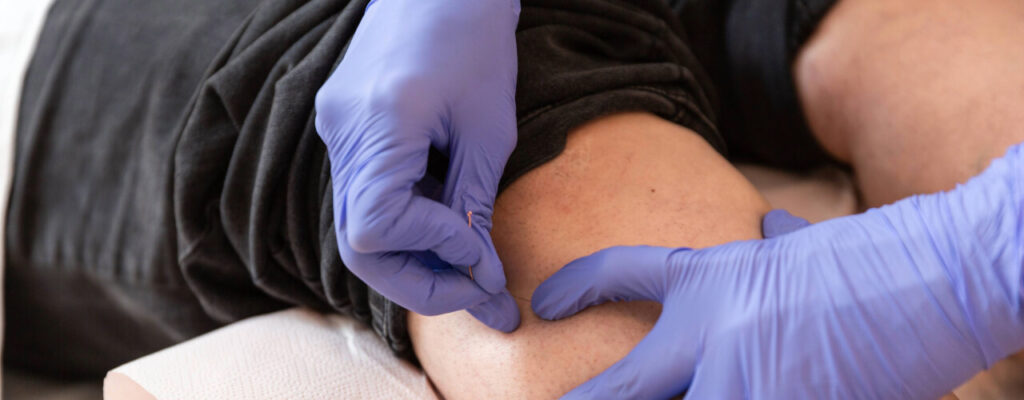 Dry Needling in Traverse City